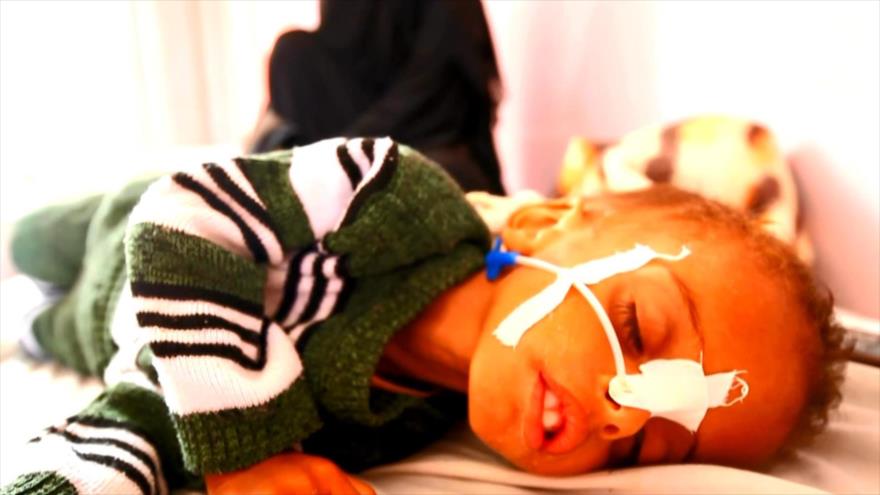 Yemen vive el peor brote de cólera en el mundo