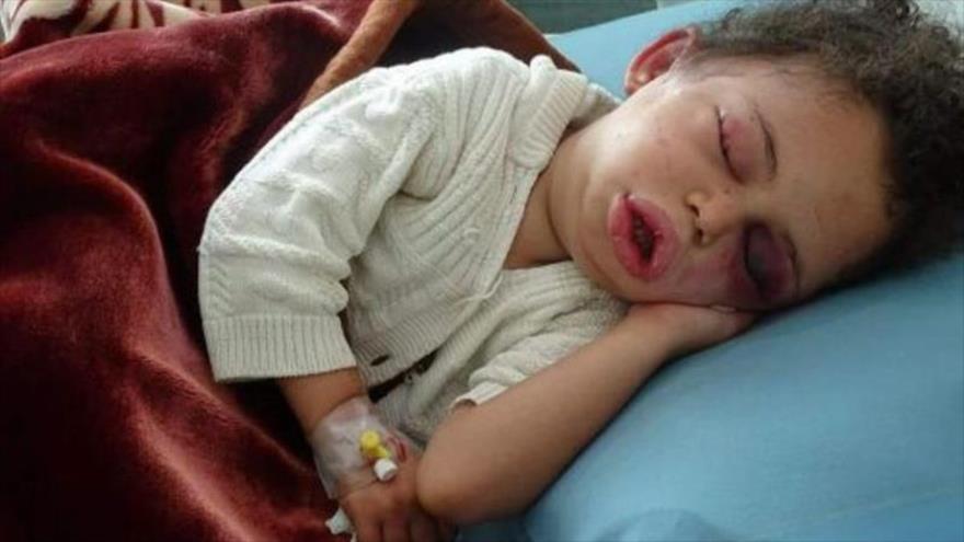 Trágica historia de niña yemení que Riad mató a toda su familia