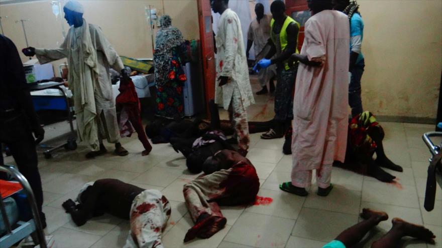 Víctimas heridas de ataque suicida perpetrado por Boko Haram esperan atención médica en un hospital en el noreste de Nigeria, 15 de agosto de 2017.