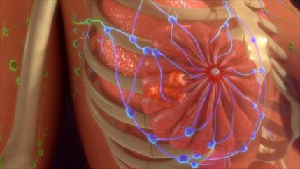 Científicos descubren nueva terapia contra la metástasis tumoral