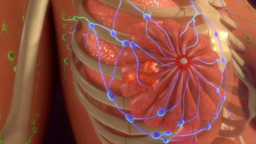 La metástasis es responsable de más del 90 por ciento de las muertes por cáncer.
