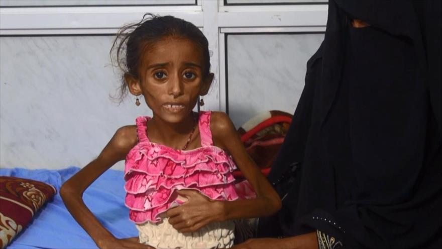 MSF: Bloqueo saudí agrava masivamente crisis humanitaria en Yemen