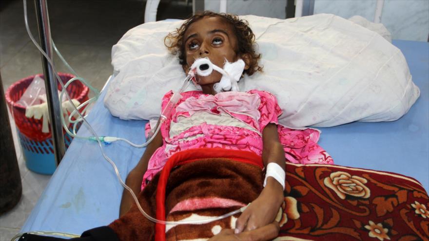 Una niña yemení, afectada por los bombardeos saudíes, fue hospitalizada en un centro médico en la ciudad de Al-Hudaydah, 14 de noviembre de 2017.