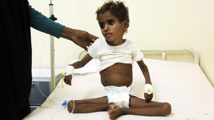 Tres agencias de la ONU piden fin del bloqueo saudí a Yemen