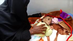 ONG piden a EEUU, Reino Unido y Francia fin de la guerra en Yemen