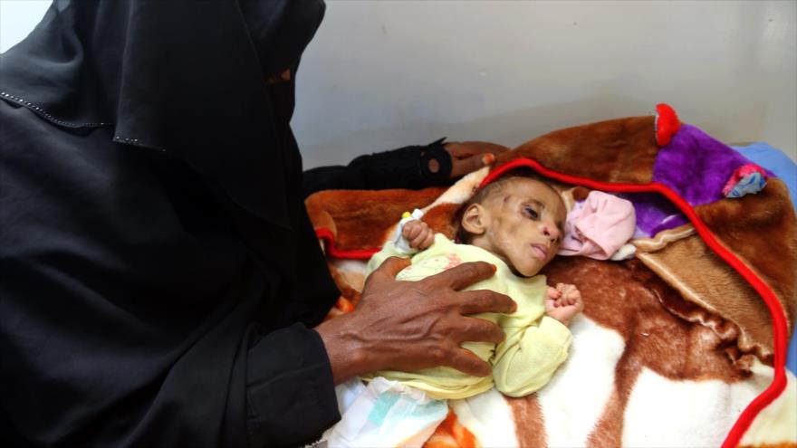 ONG piden a EEUU, Reino Unido y Francia fin de la guerra en Yemen