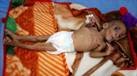 ONU: Yemen sufre una catástrofe inimaginable por culpa de Riad