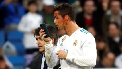 Ensangrentado, Ronaldo pide móvil en campo para verse una herida