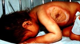 Cómo fue ataque químico que dejó miles de muertos en Halabja