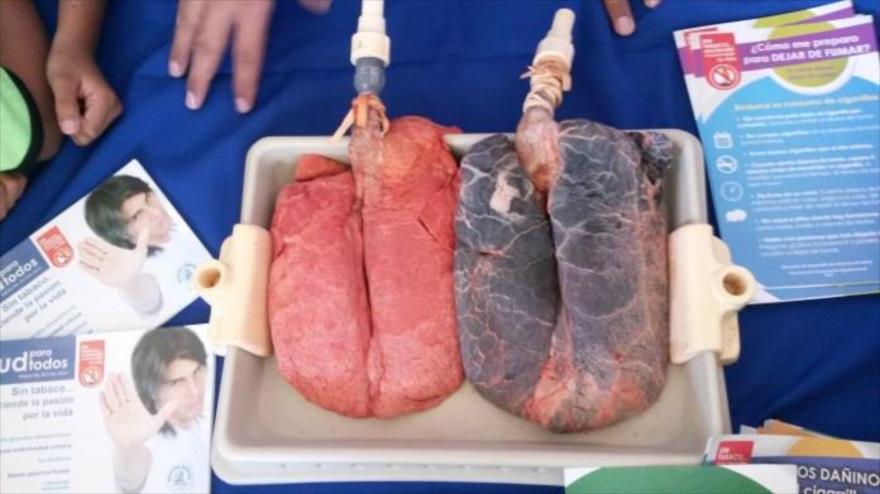 Vídeo: Vea como respiran dos pulmones, uno sano y otro canceroso | HISPANTV