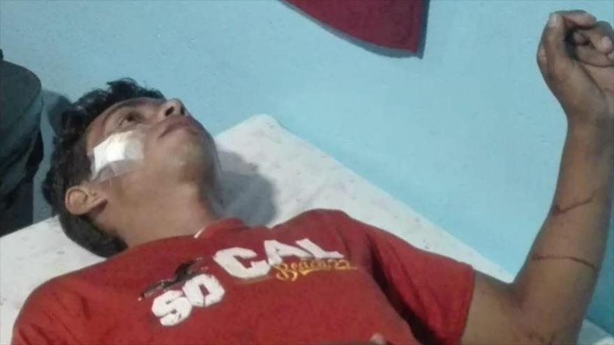 Un joven nicaragüense agredido por grupos violentos en Managua, la capital, 19 de mayo de 2018.