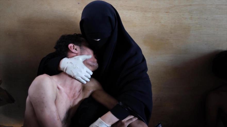 Fotos que sacuden al mundo: Madre que abraza el debilitado cuerpo de su hijo