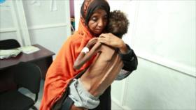 ‘Riad busca privar a Yemen de alimentos para obligarlo a rendirse’