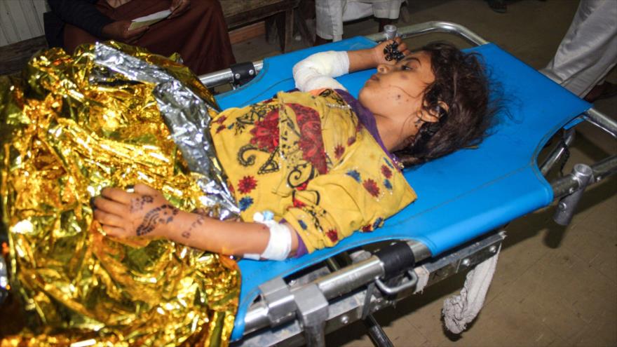 Una niña yemení herida yace en una camilla luego de un ataque aéreo de Arabia Saudí contra una boda en Saada, 3 de julio de 2018.