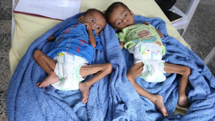 Un nuevo brote de cólera amenaza a Yemen