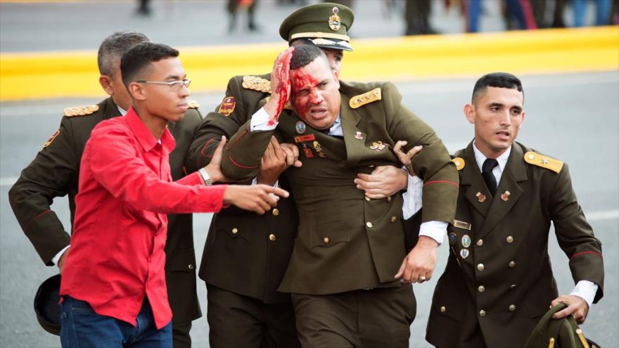 Uno de los efectivos de las Fuerzas Armadas de Venezuela, ha resultado herido tras el atentado fallido contra el presidente Nicolás Maduro, 4 de agosto de 2018.