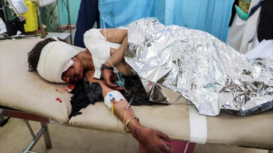 Un niño yemení yace en una cama recibiendo tratamiento después de haber sido herido en un ataque aéreo saudí en Saada,9 de agosto de 2018. Foto: AFP