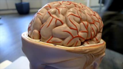 Estudio: Trabajar tras una lesión cerebral acelera la recuperación
