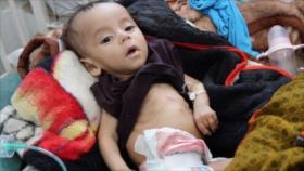 ONU reconoce su incapacidad de combatir la hambruna en Yemen