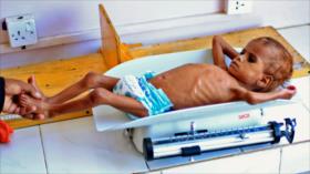 ONU: Yemen tiene la peor situación humanitaria del mundo