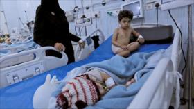 ‘Caso Khashoggi no debe desviar atención de crímenes en Yemen’