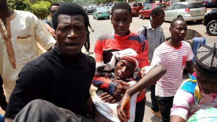 Ciudadanos nigerianos trasladan a los musulmanes chiíes heridos por el Ejército en la ciudad de Abuja, 16 de abril de 2018.