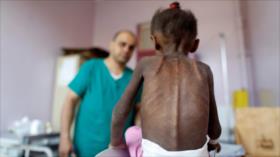 Unicef: Yemen ya es un “infierno terrenal” para los niños 