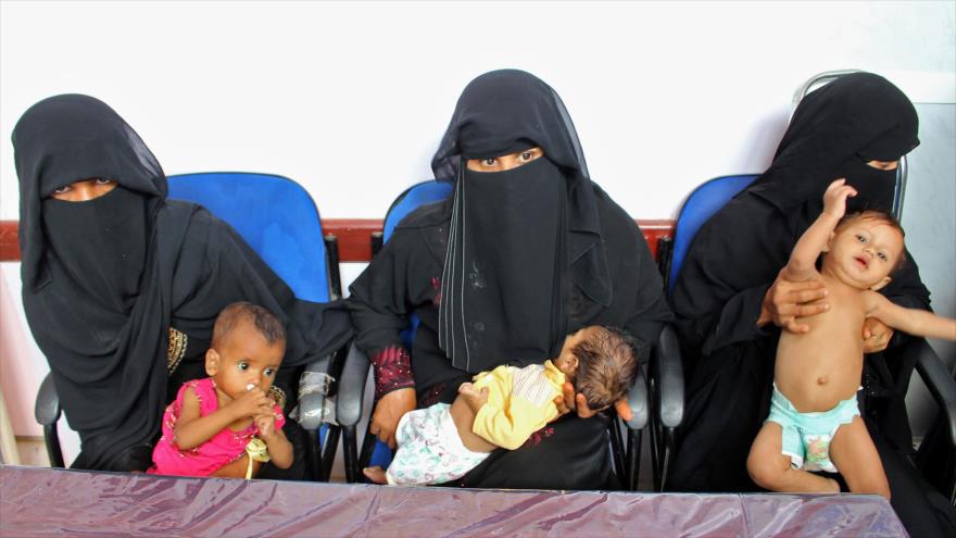 Niños con malnutrición en un hospital en el noroeste de Yemen, 7 de noviembre de 2018. (Foto: AFP)