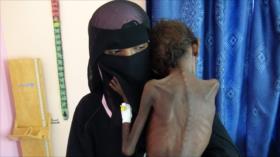 Yemen denuncia envío de alimentos ‘en mal estado’ por la ONU