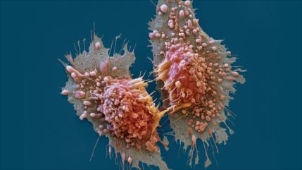 Descubren un modo de controlar genes que impulsan el cáncer