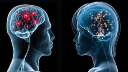 Estudio: cerebro femenino luce 3 años más jóven que el masculino