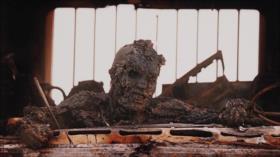Fotos que sacuden al mundo: Soldado iraquí quemado