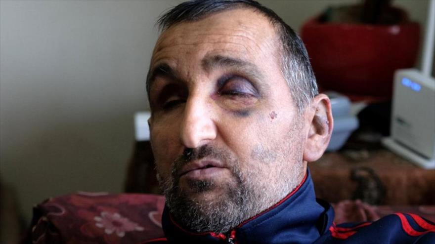 Vídeo impactante: Soldados israelíes golpean a un hombre ciego | HISPANTV