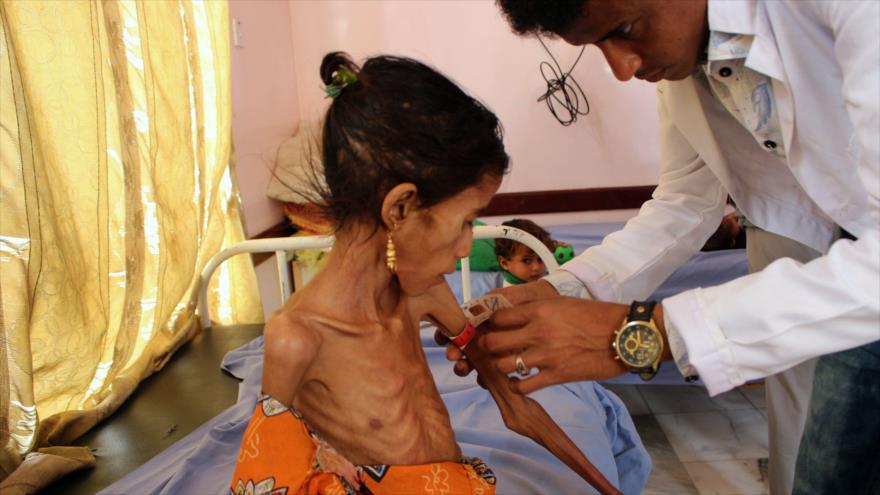 ONU alerta: Cada día, 8 niños mueren o resultan heridos en Yemen | HISPANTV