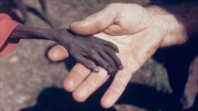 Fotos que sacuden al mundo: La mano del niño ugandés