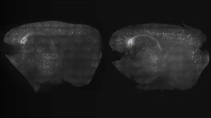 Luces y Sonidos: ¿Un posible tratamiento para el alzhéimer? 