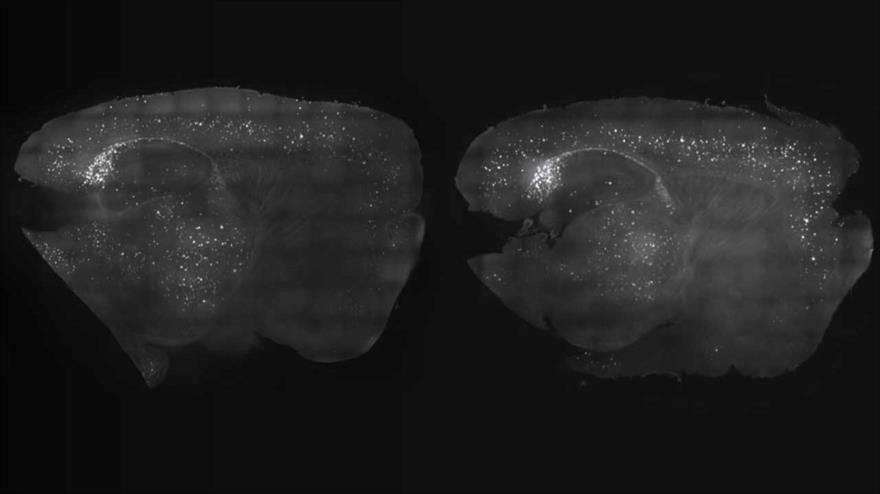 Comparación de cortezas cerebrales de dos ratones con (izda.) y sin tratamiento a base de estimulación visual y auditiva.