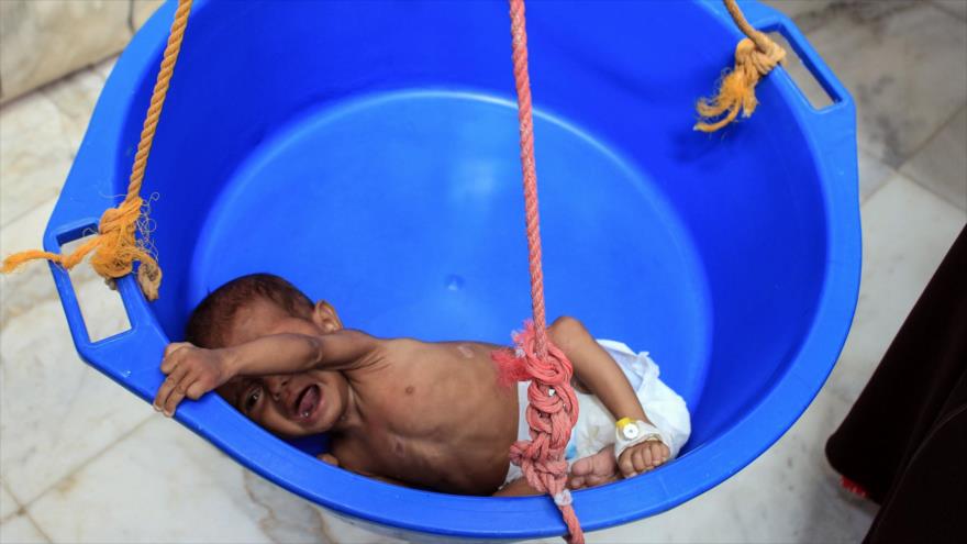 Yemen: 100 000 niños podrán morir en un año por la agresión saudí | HISPANTV