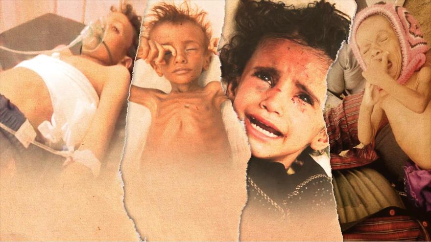 Aniversario mortal: 4 años de guerra contra la infancia en Yemen | HISPANTV