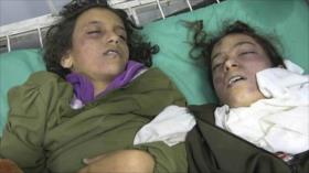 Unicef: 14 niños murieron en el reciente ataque saudí a Yemen