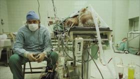 Fotos que sacuden al mundo: La primera cirugía de trasplante de corazón