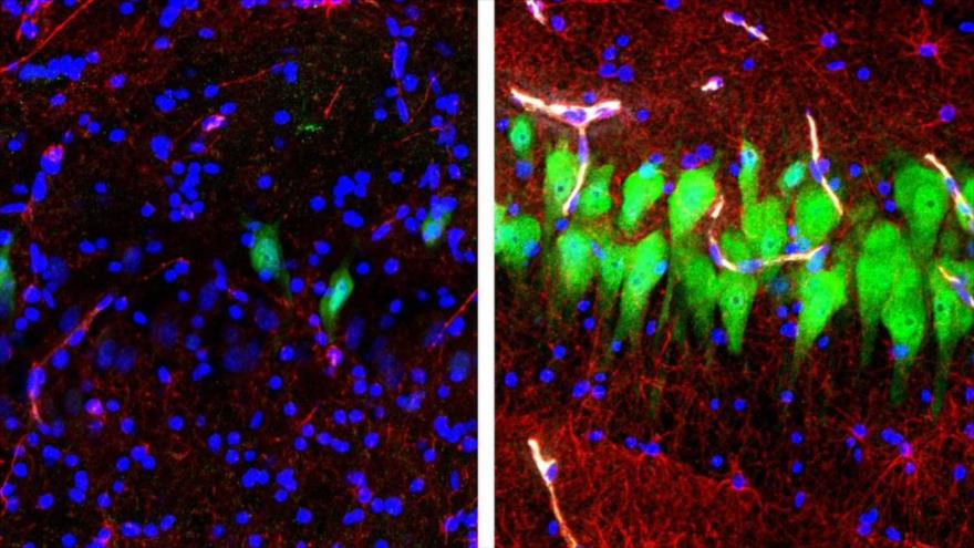CÃ©lulas neuronales (verde) mueren rÃ¡pidamente si no se tratan (izda.), pero, una tecnologÃ­a pudo ayudar a mantenerlas vivas durante 10 horas (dcha).