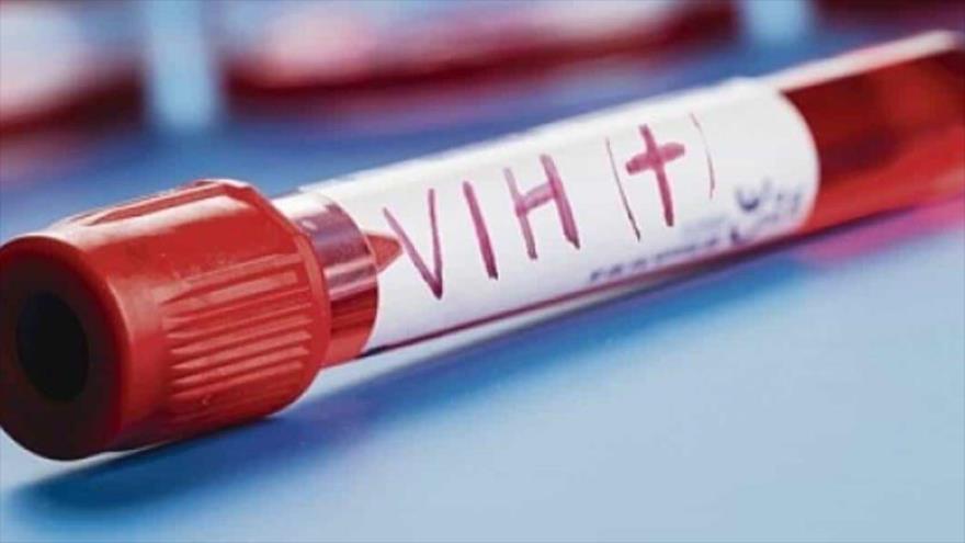 Muestra de sangre de paciente con VIH positivo.