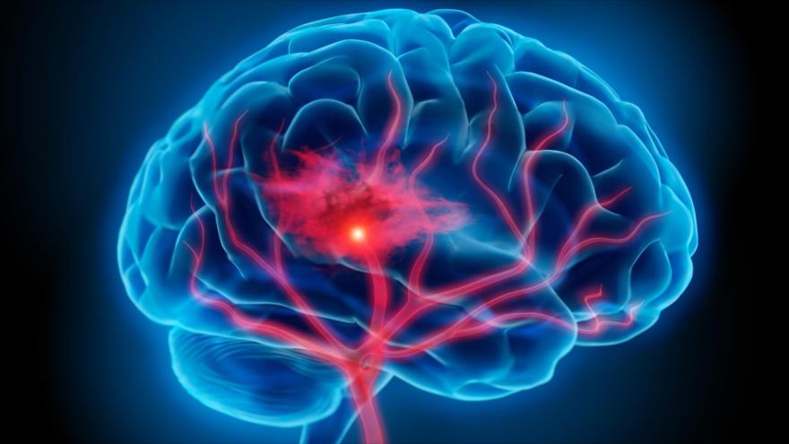 Actividad física puede prevenir el envejecimiento cerebral | HISPANTV