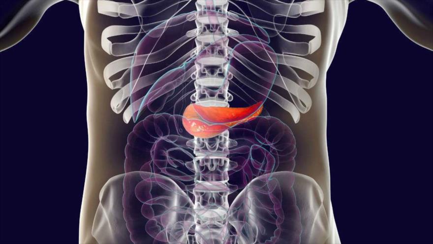Descubren fármaco que frena propagación de cáncer de páncreas
