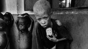 Fotos que sacuden al mundo: Guerra entre Nigeria y Biafra