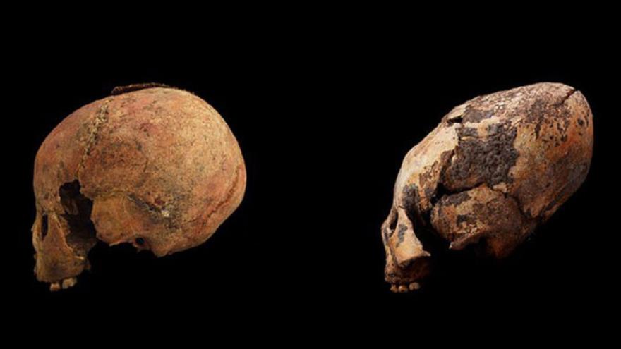 Los cráneos de dos niños de 8 años comparados; el de la Izda. sin modificar y el de la dcha. alargado (Foto: American Journal of Physical Anthropology)