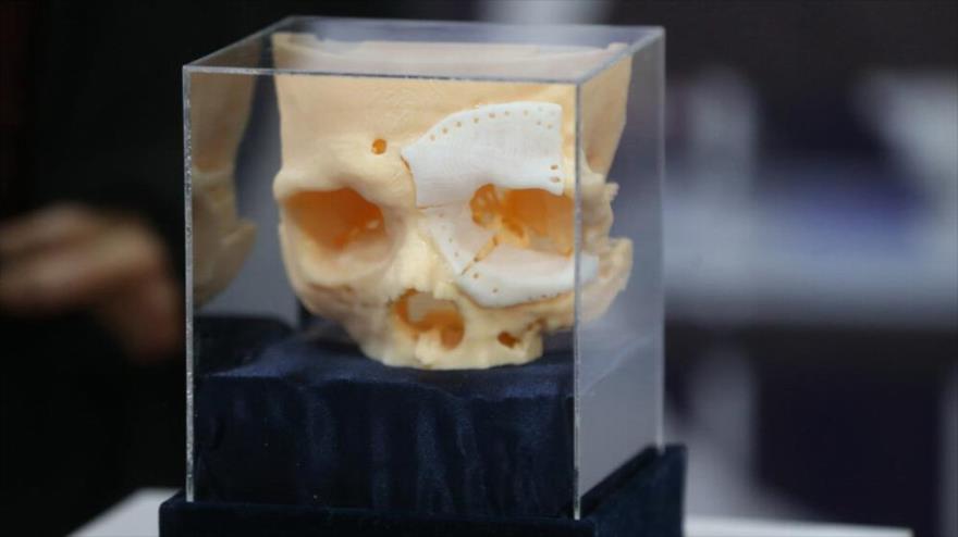 Vídeo: Irán fabrica huesos artificiales en tres dimensiones | HISPANTV