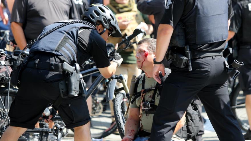 Brutalidad policial es una causa de muerte de jóvenes en EEUU | HISPANTV
