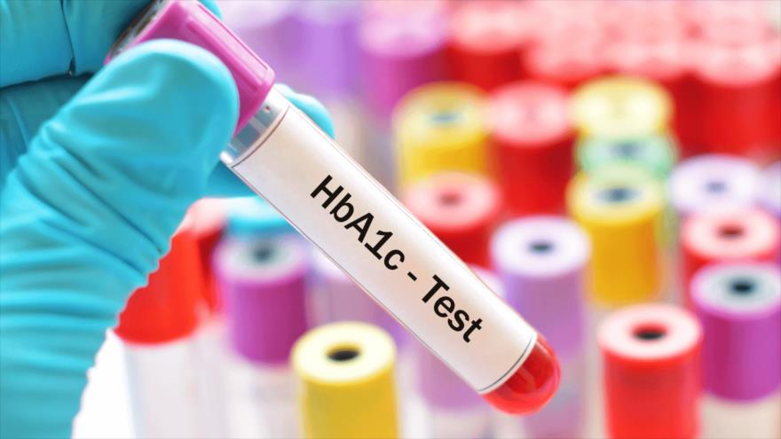 HbA1c es una prueba que todo diabético debe conocer para medir los niveles medios de glucosa en sangre.